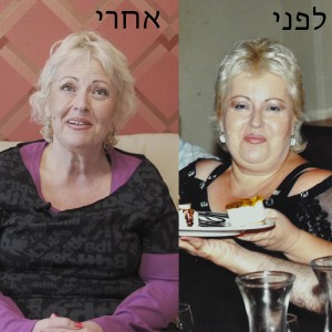 before-after-2